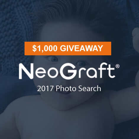 Neograft Photo Search 2017